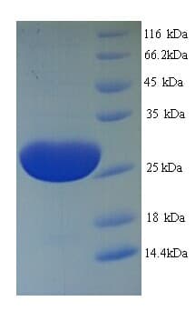 Trichosanthes kirilowii Karasurin-C Protein (Recombinant His)