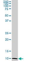 ATP6V1G2 Antibody (clone 2E11)