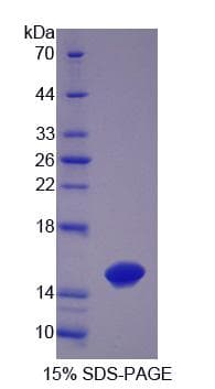 Human TCHH / Trichohyalin Protein (Recombinant 6His, N-terminus)