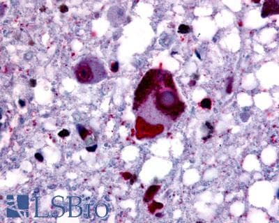 PathPlus™ Polyclonal Rabbit anti-Human GPER1 / GPR30 Antibody (Cytoplasmic Domain, IHC, IF, WB)