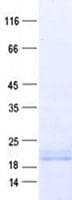 Human PPIAL4E Protein (Recombinant His, N-Terminal)