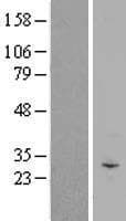 SMCO1 Protein (Over-Expression Lysate Myc-DDK (Flag))