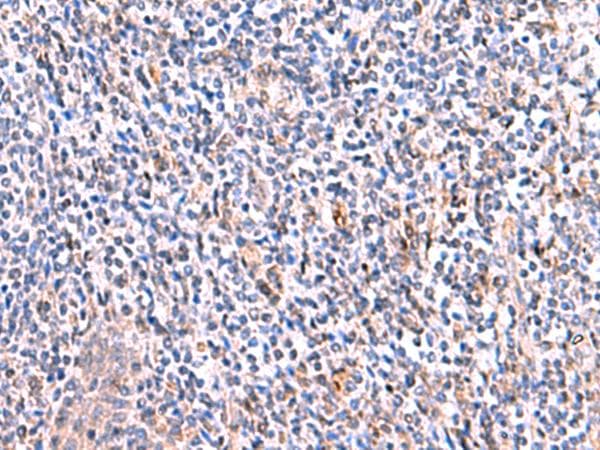 Polyclonal Rabbit anti-Human SMPD2 Antibody (IHC, WB)