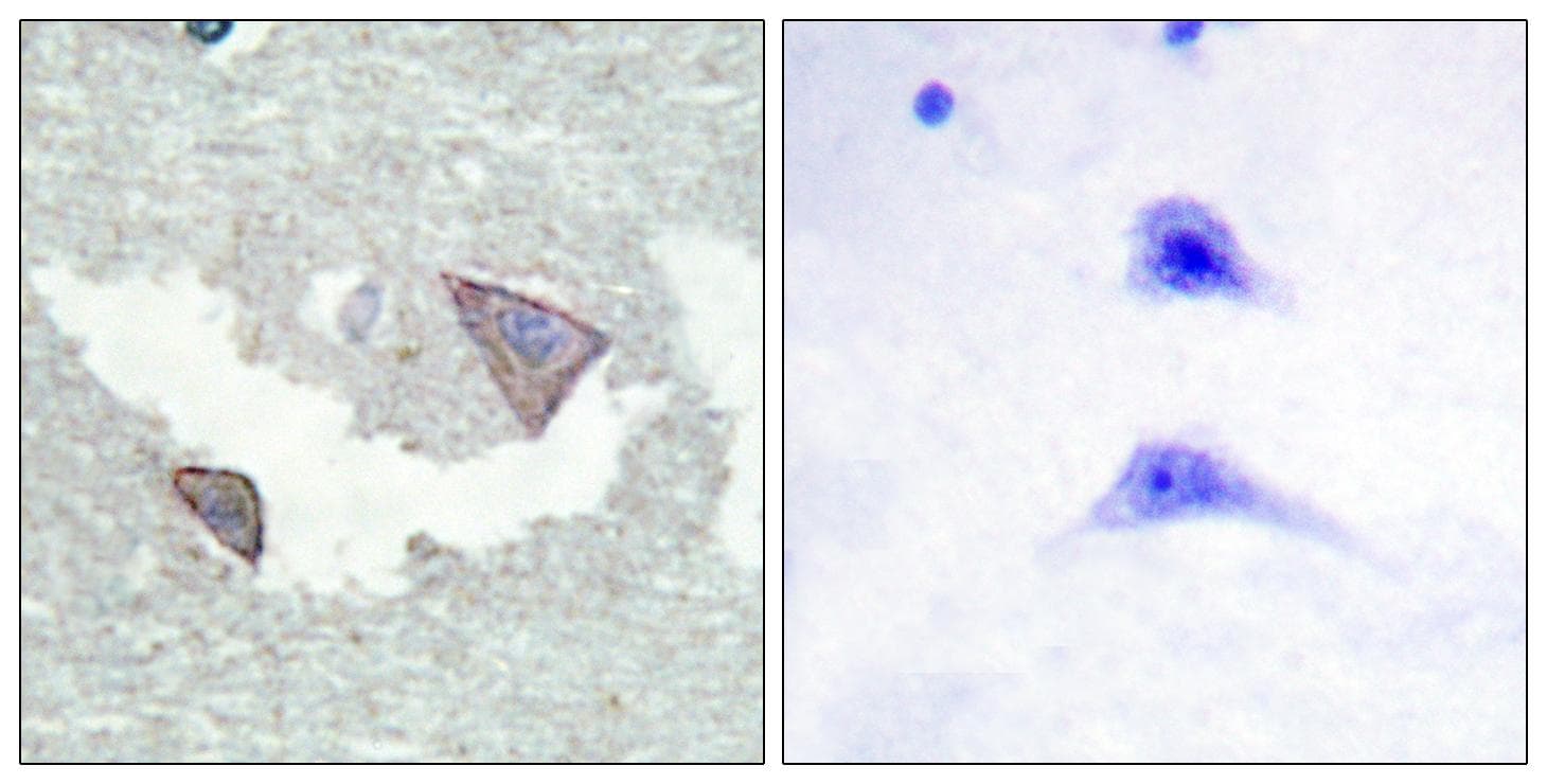 PDGFRA / PDGFR Alpha Antibody (phospho-Tyr754)