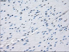 PRKAR1A Antibody (clone OTI6C7)