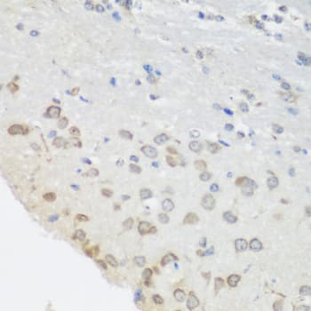 PUM1 Antibody
