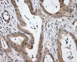 HDAC10 Antibody (clone OTI8G5)