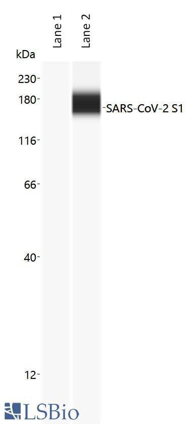 SARS-CoV-2 Spike Glycoprotein Antibody
