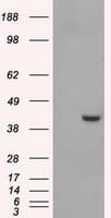 PME-1 / PPME1 Antibody (clone OTI4A12)