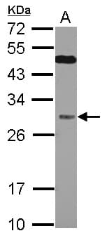 QDPR / DHPR Antibody