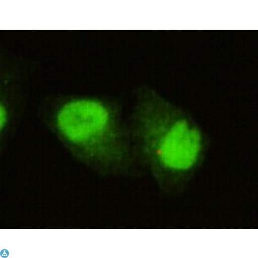 KDM5C / Jarid1C / SMCX Antibody
