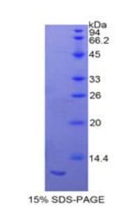 Rat Calgizzarin / S100A11 Protein (Recombinant His)