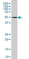 Monoclonal Mouse anti-Human MCHR1 Antibody (clone 3D7, WB)