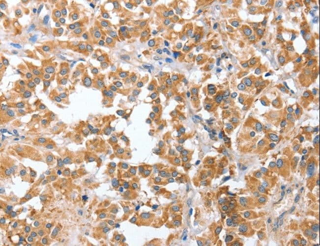 CIAPIN1 / Anamorsin Antibody