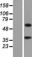Human ALAS2 Protein (Over-Expression Lysate Myc-DDK (Flag))