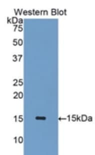 IL15 Antibody (aa50-162)