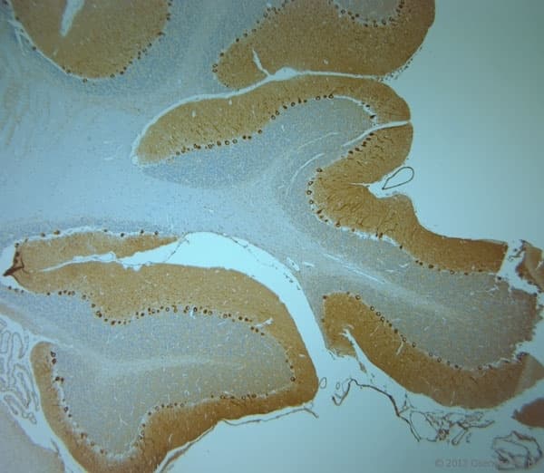 Polyclonal Rabbit anti-Human ITPR1 / IP3 Receptor Type 1 Antibody (aa700-750, IHC)