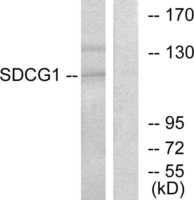SDCCAG1 / NEMF Antibody