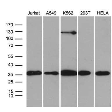 PDCL3 Antibody (clone OTI6G6)