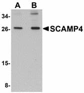 IHC-plus™ SCAMP4 Antibody