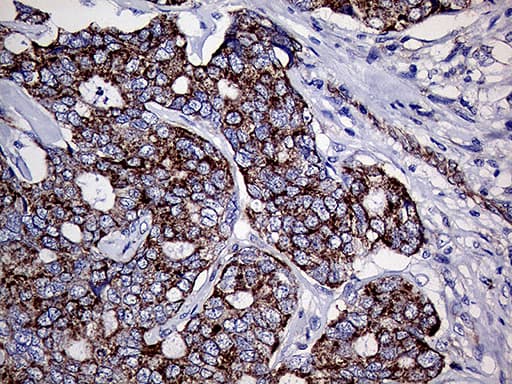 TGM2 / Transglutaminase 2 Antibody (clone OTI4H5, Carrier-free)