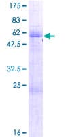 Human AEBP2 Protein (Recombinant GST)