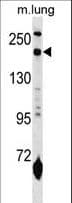 IHC-plus™ Polyclonal Rabbit anti-Human Mannose Receptor / CD206 Antibody (aa359-388, IHC, WB)