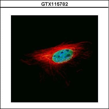 L3MBTL1 Antibody