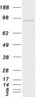Human MCM6 Protein (Recombinant Myc-DDK (Flag))