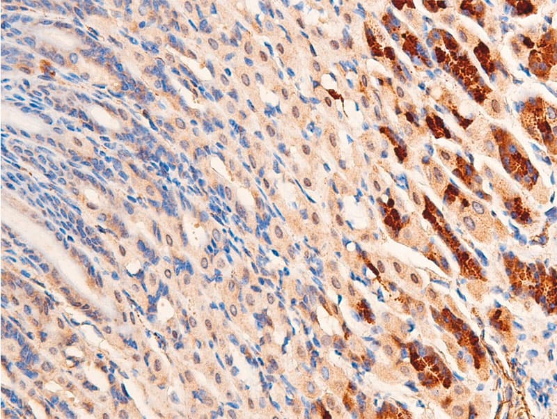 Polyclonal Rabbit anti-Human CHEK1 / CHK1 Antibody (phospho-Ser296, IHC, IF, WB)