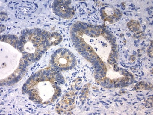 CDH1 / E Cadherin Antibody (clone UMAB184)