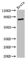 Polyclonal Rabbit anti-Human SV2B Antibody