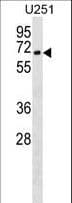 CORO2B Antibody (aa1-27)