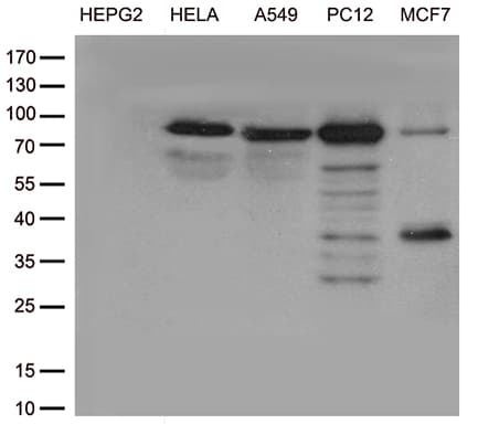 Monoclonal Mouse anti-Human TTC7A Antibody (clone OTI6D2, aa1-450, WB)