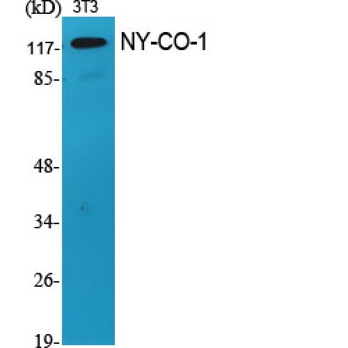 SDCCAG1 / NEMF Antibody (850-930 aa, C-terminal)