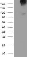 GPR49 / LGR5 Antibody (aa250-550, clone OTI8C9)