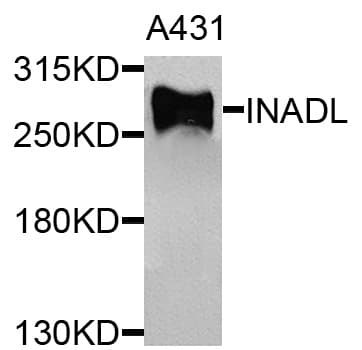 Polyclonal Rabbit anti-Human INADL / PATJ Antibody (WB)