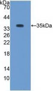 PRKCB / PKC-Beta Antibody (aa342-600)