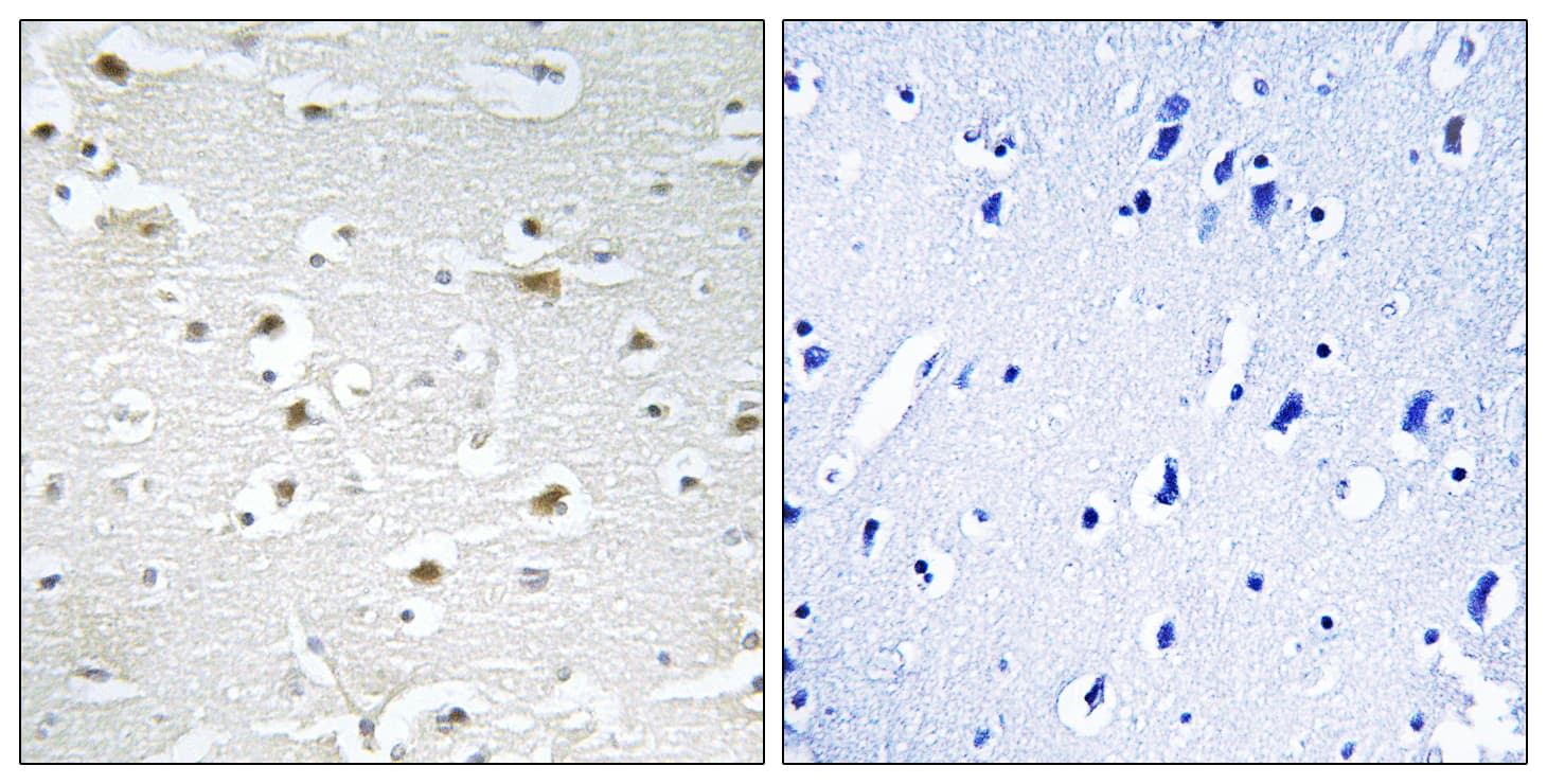 DDX3Y Antibody (aa41-90)