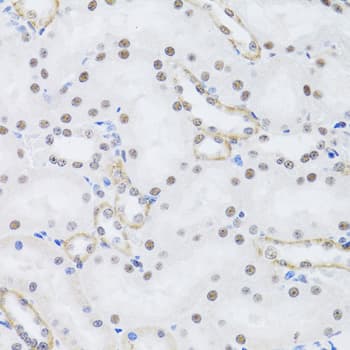 PRPF19 / PRP19 Antibody