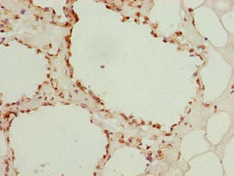 LGALS12 / Galectin 12 Antibody