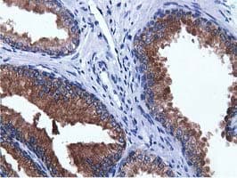 ADI1 / ARD Antibody (clone OTI5C2, Carrier-free)
