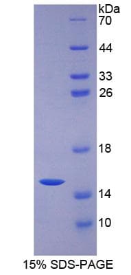 Rat VEGFC Protein (Recombinant His)