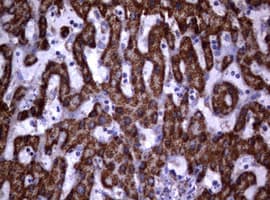 PIK3CD / PI3K Delta Antibody (aa286-610, clone OTI2D9)