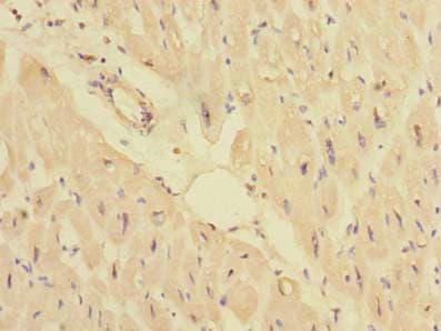 PPM1M Antibody
