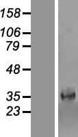 PARM1 Protein (Over-Expression Lysate Myc-DDK (Flag))