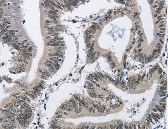 CMTM2 Antibody