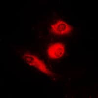 FOXO4 / AFX1 Antibody (phospho-Ser197)