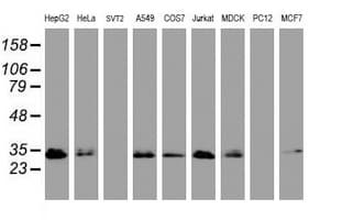 PPT1 / CLN1 Antibody (aa100-306, clone OTI1A10, Carrier-free)