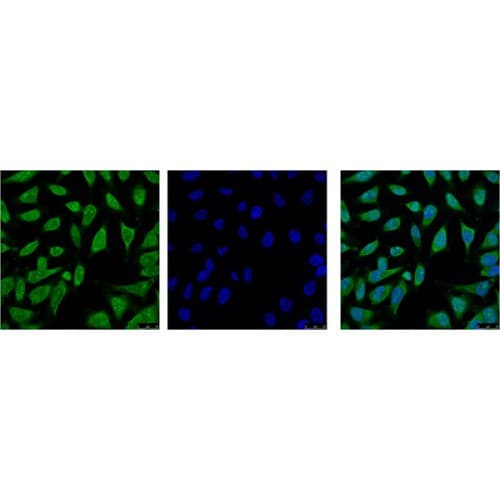 HSP70 / Heat Shock Protein 70 Antibody (clone 3G10)